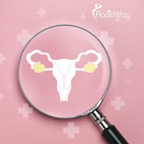 Advanced Ovarian Cancer Treatment in Tijuana - New Hope for Cancer Patients